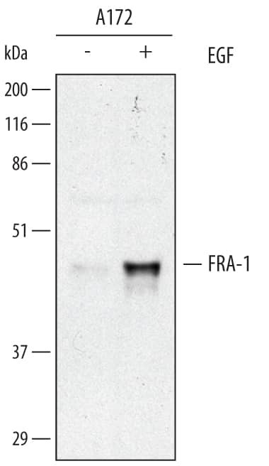 Fra1 Antibody in Western Blot (WB)