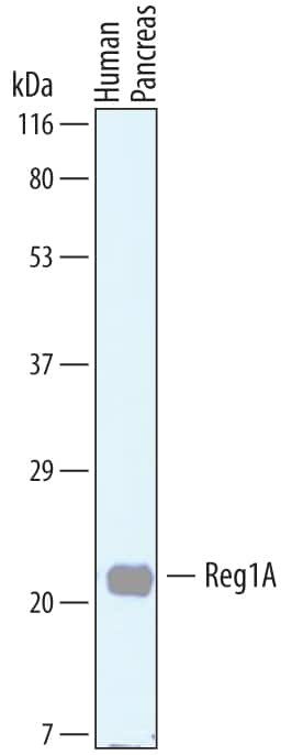 REG1A/REG1B Antibody in Western Blot (WB)