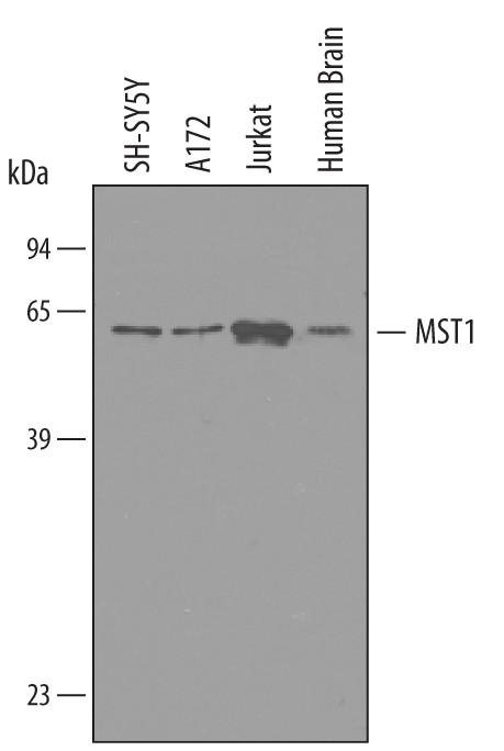 MST1 (STK4) Antibody in Western Blot (WB)