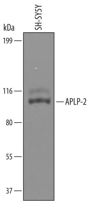 APLP2 Antibody in Western Blot (WB)