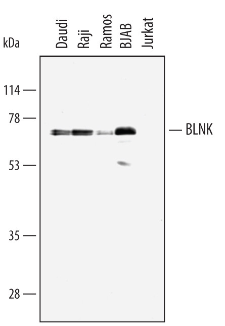 BLNK Antibody in Western Blot (WB)