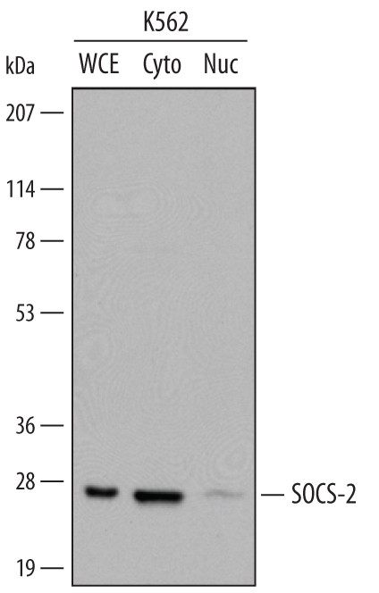 SOCS2 Antibody in Western Blot (WB)