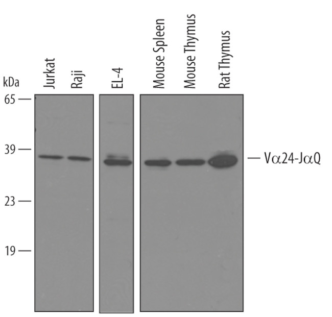 TCR V alpha 24 J alpha 18 Antibody in Western Blot (WB)
