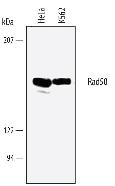 RAD50 Antibody in Western Blot (WB)
