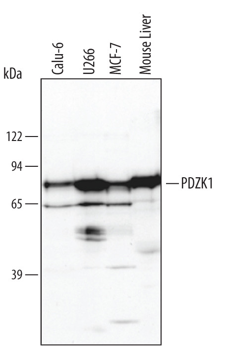 PDZK1 Antibody in Western Blot (WB)