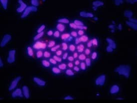 HOXA1 Antibody in Immunocytochemistry (ICC/IF)