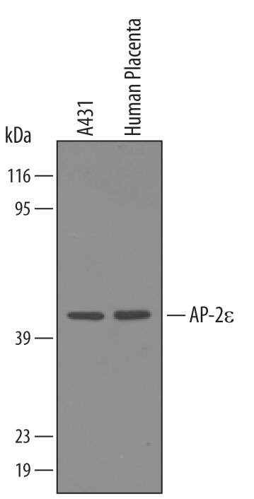 TFAP2E Antibody in Western Blot (WB)