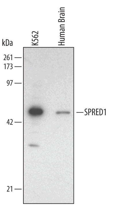 SPRED1 Antibody in Western Blot (WB)