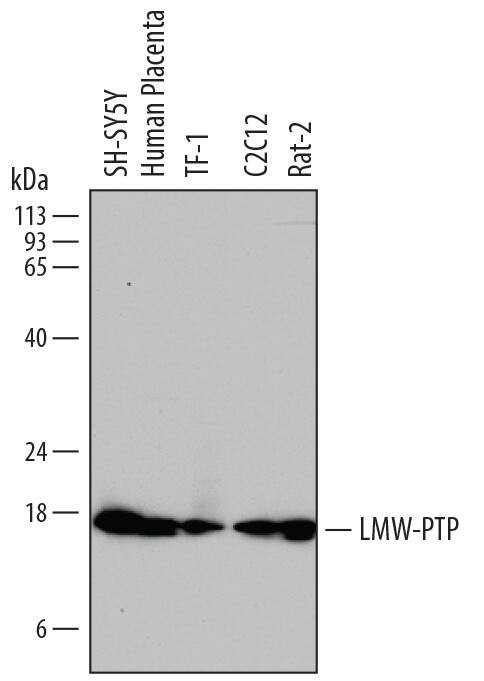 Acid Phosphatase 1 Antibody in Western Blot (WB)