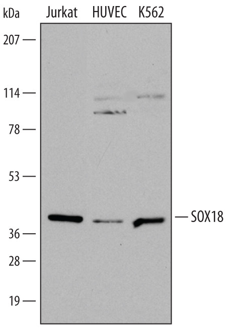 SOX18 Antibody in Western Blot (WB)