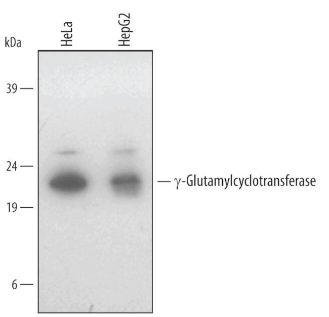 GGCT Antibody in Western Blot (WB)