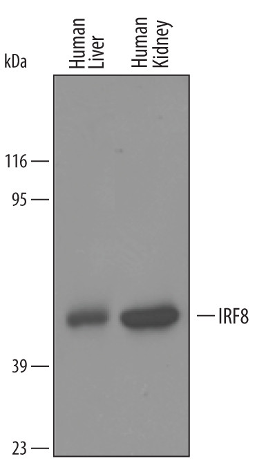 IRF8 Antibody in Western Blot (WB)