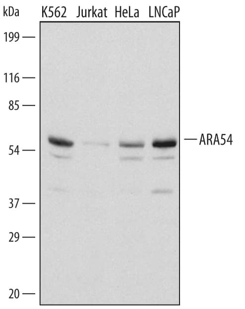 RNF14 Antibody in Western Blot (WB)