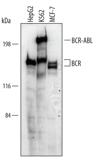 Bcr Antibody in Western Blot (WB)