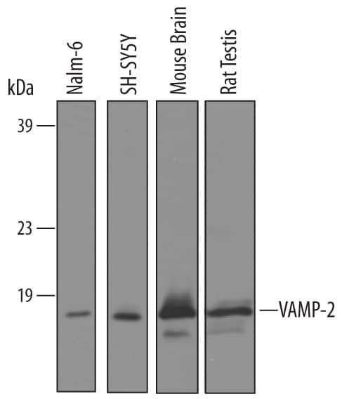 VAMP2 Antibody in Western Blot (WB)
