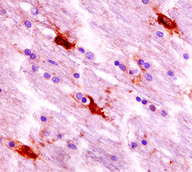 S100A16 Antibody in Immunohistochemistry (Paraffin) (IHC (P))