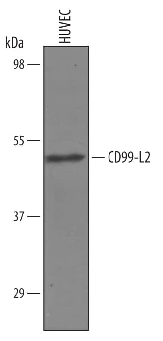 CD99L2 Antibody in Western Blot (WB)
