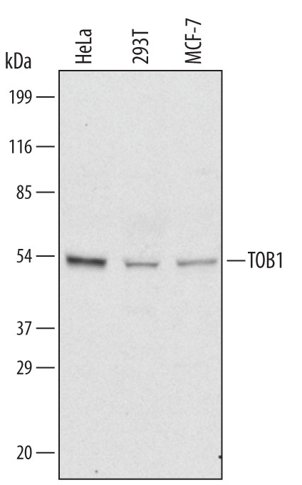 TOB1 Antibody in Western Blot (WB)