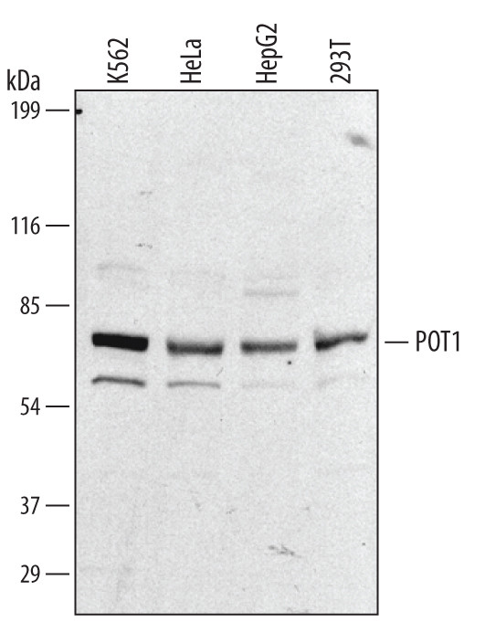 POT1 Antibody in Western Blot (WB)