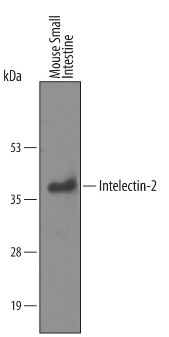 ITLN2 Antibody in Western Blot (WB)