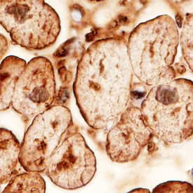 ATGL Antibody in Immunohistochemistry (Paraffin) (IHC (P))