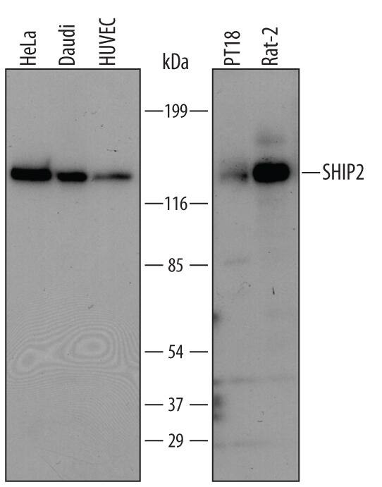 SHIP2 Antibody in Western Blot (WB)