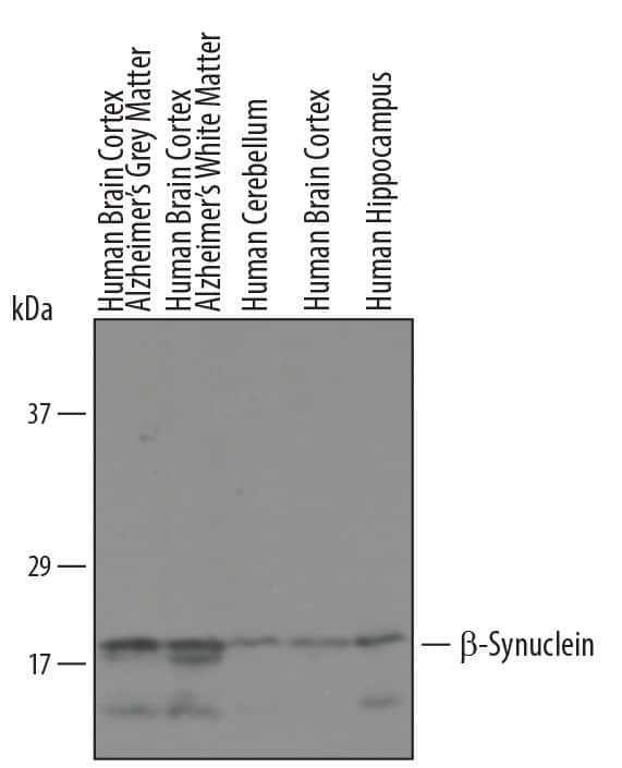 beta Synuclein Antibody in Western Blot (WB)