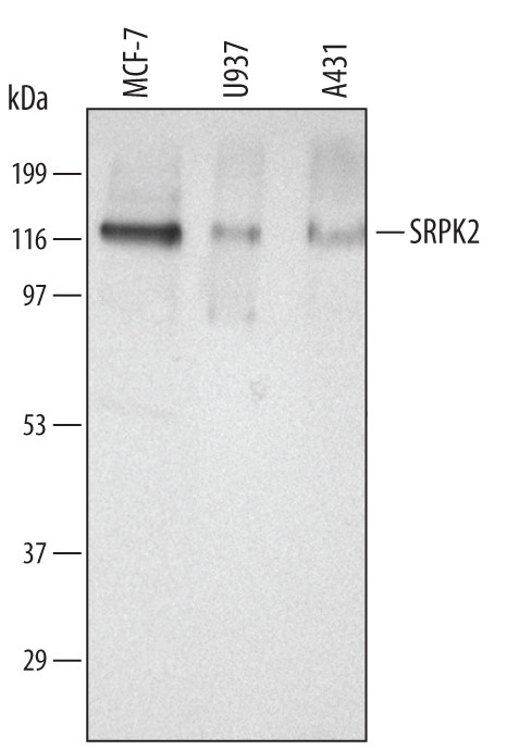 SRPK2 Antibody in Western Blot (WB)