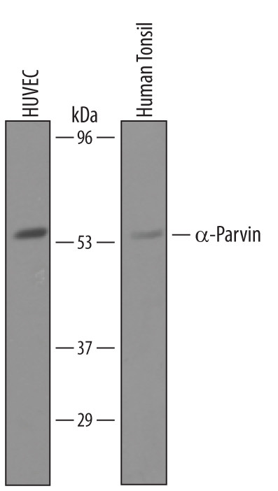 PARVA Antibody in Western Blot (WB)