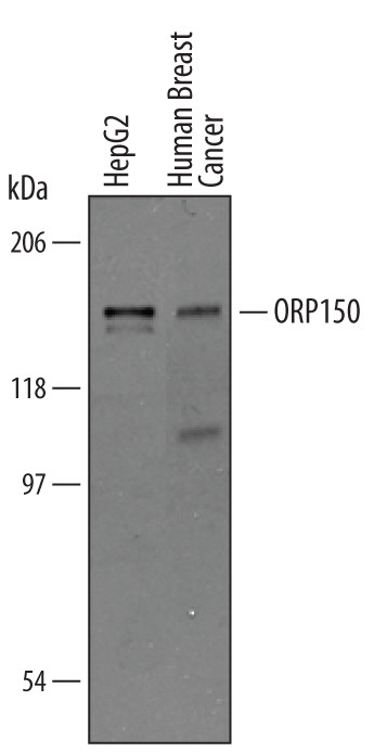 HYOU1 Antibody in Western Blot (WB)
