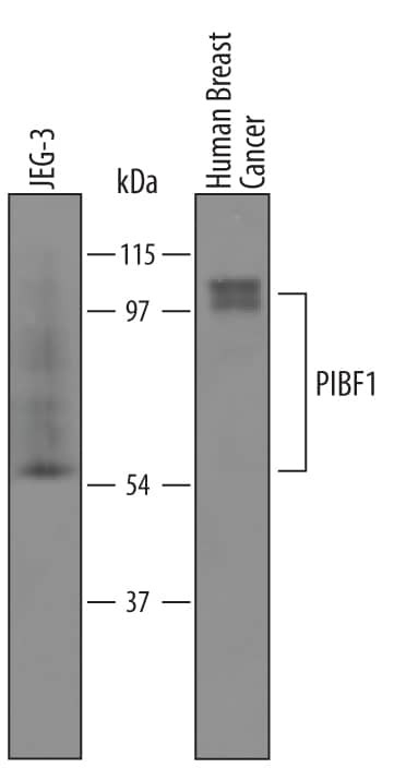 PIBF1 Antibody in Western Blot (WB)