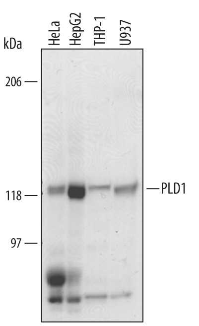 PLD1 Antibody in Western Blot (WB)