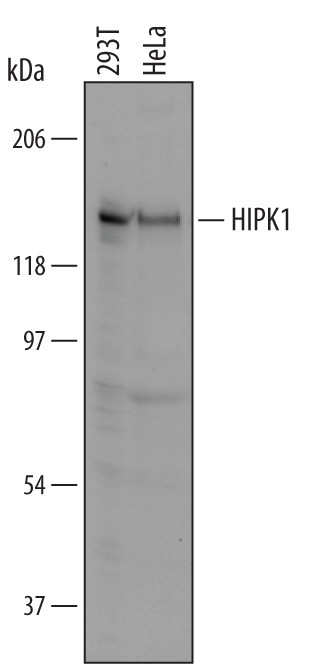 HIPK1 Antibody in Western Blot (WB)