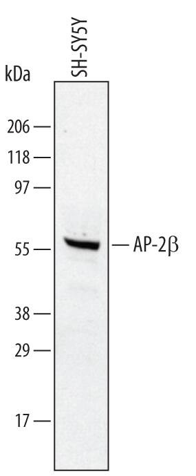 AP2 beta Antibody in Western Blot (WB)