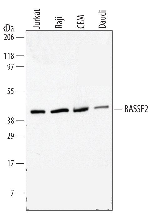 RASSF2 Antibody in Western Blot (WB)