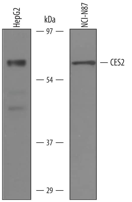 CES2 Antibody in Western Blot (WB)