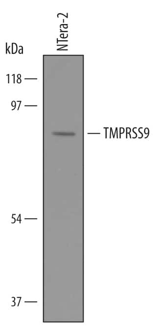 TMPRSS9 Antibody in Western Blot (WB)