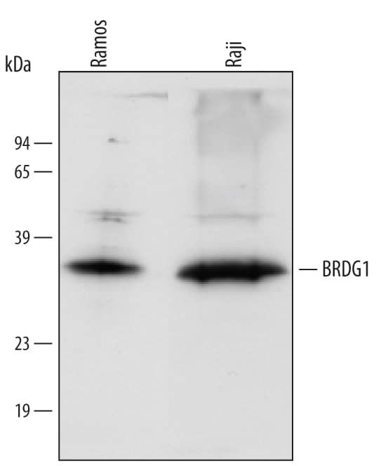STAP1 Antibody in Western Blot (WB)
