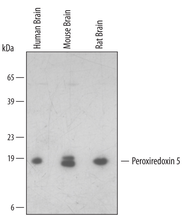 PRDX5 Antibody in Western Blot (WB)