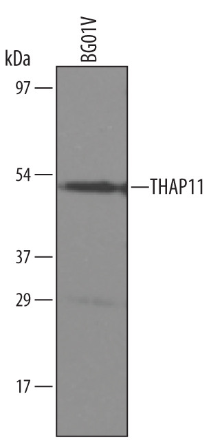 THAP11 Antibody in Western Blot (WB)