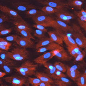 SIK2 Antibody in Immunocytochemistry (ICC/IF)