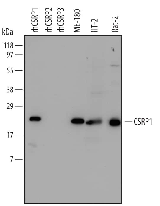 CSRP1 Antibody in Western Blot (WB)