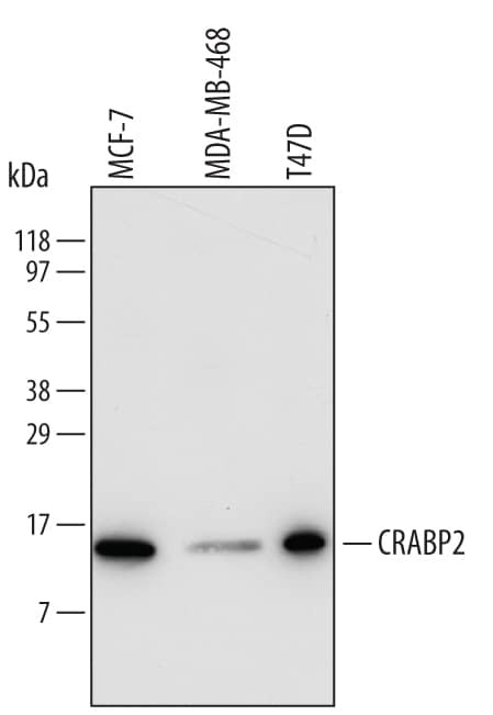 CRABP2 Antibody in Western Blot (WB)