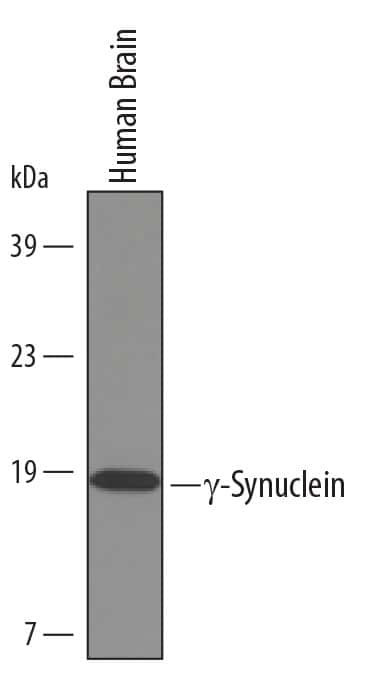 gamma Synuclein Antibody in Western Blot (WB)