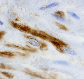 TGM4 Antibody in Immunohistochemistry (Paraffin) (IHC (P))