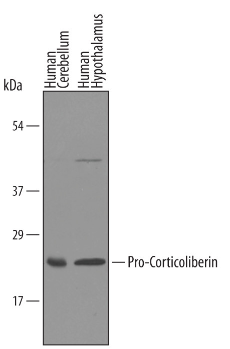 pro-CRF Antibody in Western Blot (WB)