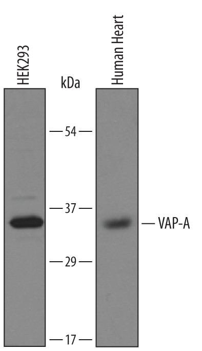 VAPA Antibody in Western Blot (WB)