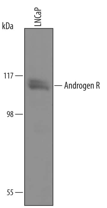 Androgen Receptor Antibody in Western Blot (WB)