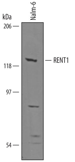 UPF1 Antibody in Western Blot (WB)