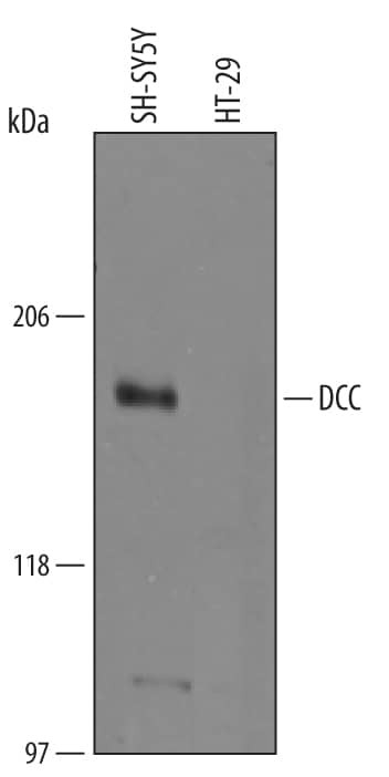 DCC Antibody in Western Blot (WB)